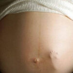 Quando fare le indagini prenatali? Villocentesi, Amniocentesi, e test genetici